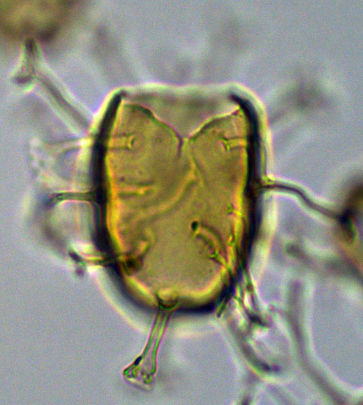 Hystrichosphaeridium tubiferum 2 Htub27X23334295c.jpg